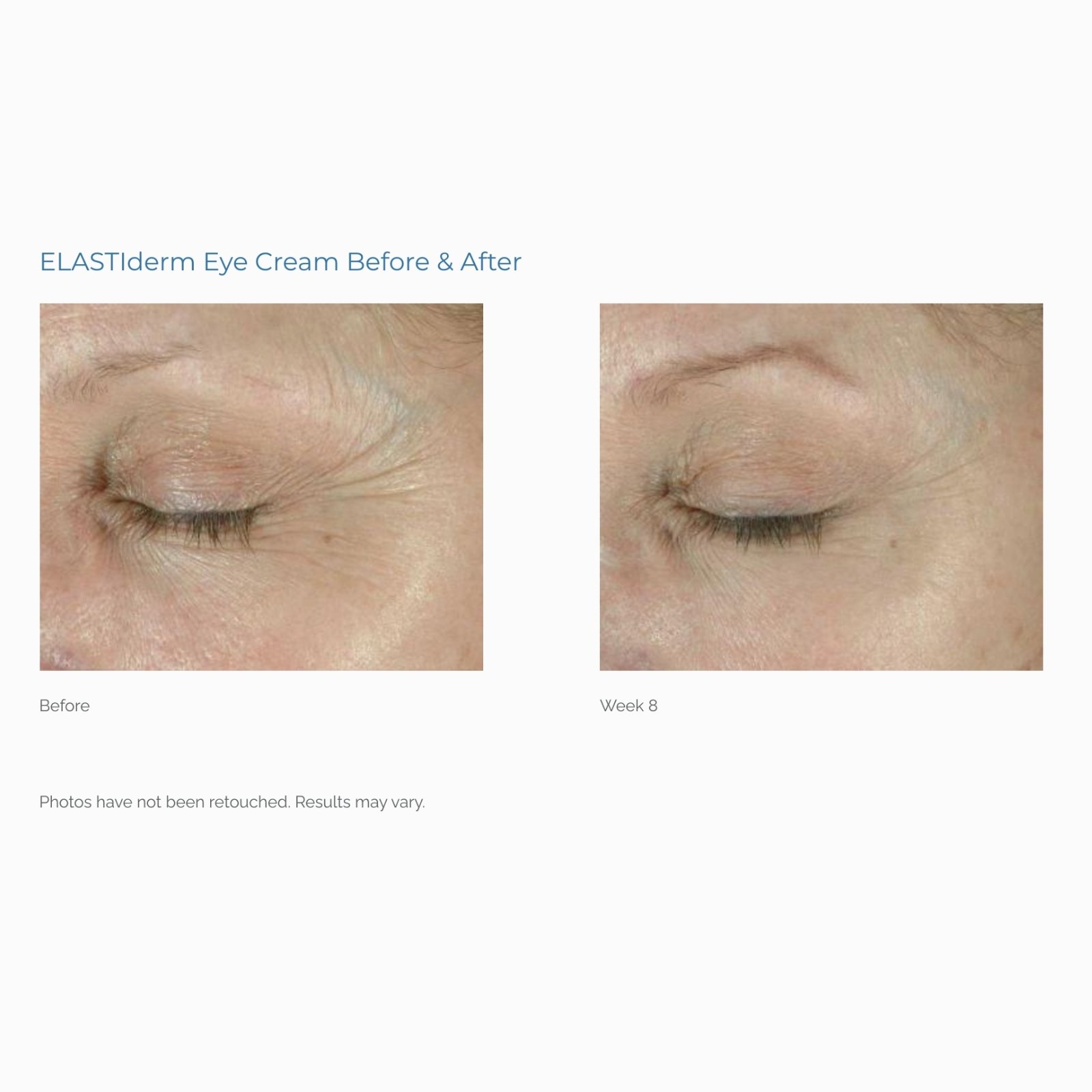 ObagiElastidermEyeCreamBeforeAfter_1600x1600