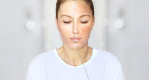 Hyperpigmentation and Melasma